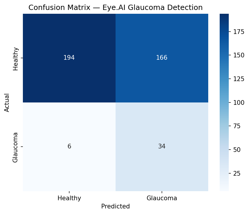 Eye AI Disease Detection